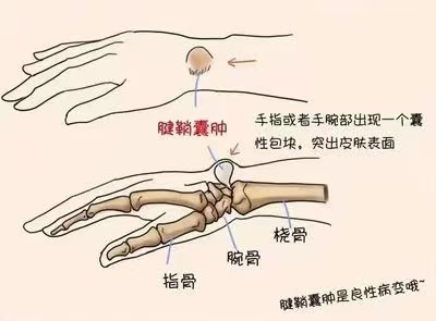 手踝的位置图片图片